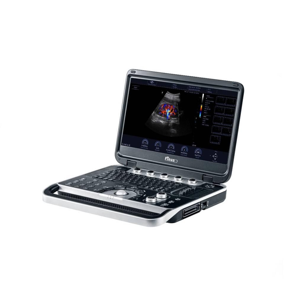 Ультразвукова діагностична система портативна Finus 45 Focus&Fusion Дніпро - фото 7