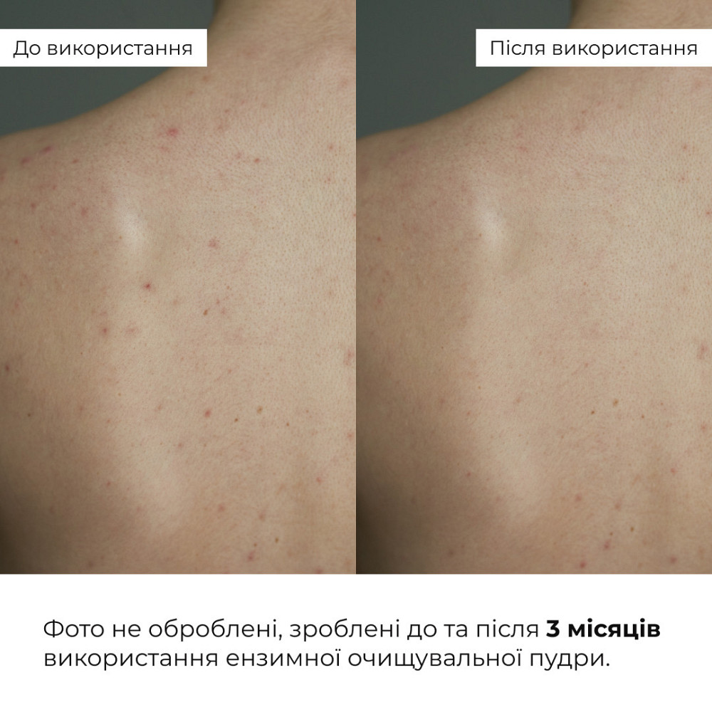 Энзимная очищающая пудра для жирной и комбинированной кожи HiLLARY Enzyme Balance Cleanser Powder, 40 г Киев - изображение 18