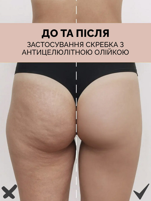 Антицеллюлитный массажный набор для тела: Скребок гуаша+горячее масло Reclaire cosmetics Киев - изображение 6