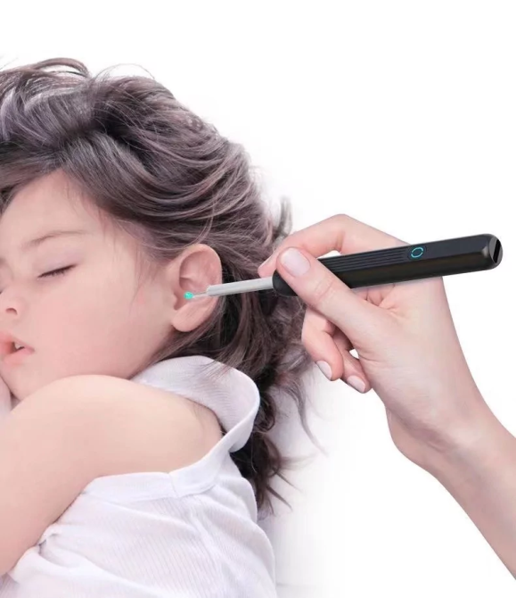 Беспроводной прибор для чистки ушей NE3 отоскоп Винница - изображение 8