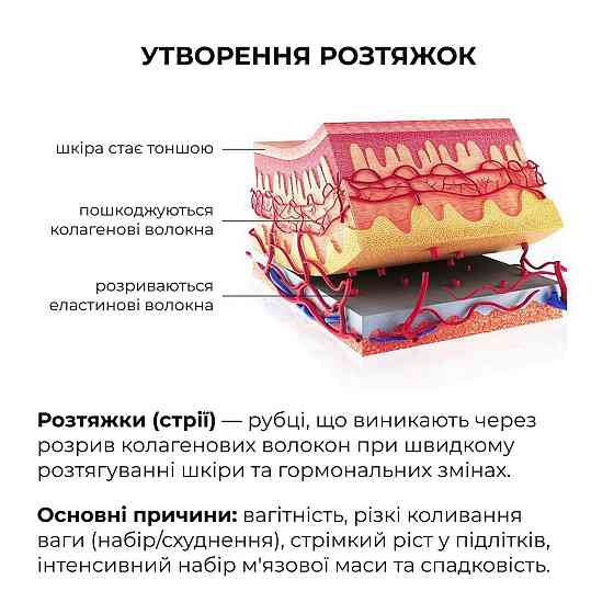 Cкраб з олією ксименії для попередження появи розтяжок Hillary Ximenia Radiance Body Scrub, 200 г Київ