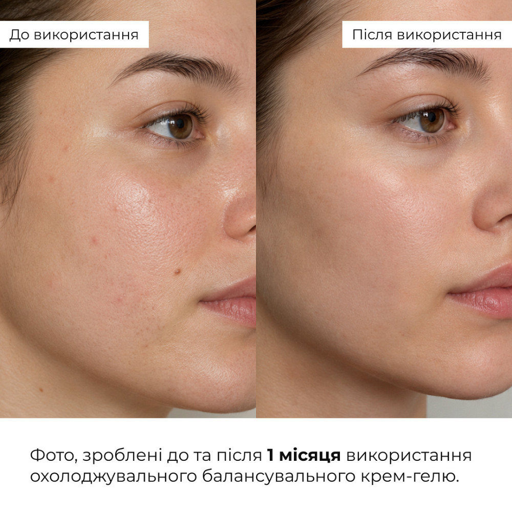 Комплекс ежедневного ухода для жирной и комбинированной кожи Hillary Daily Care Complex for Oily & Combination Skin Киев - изображение 10