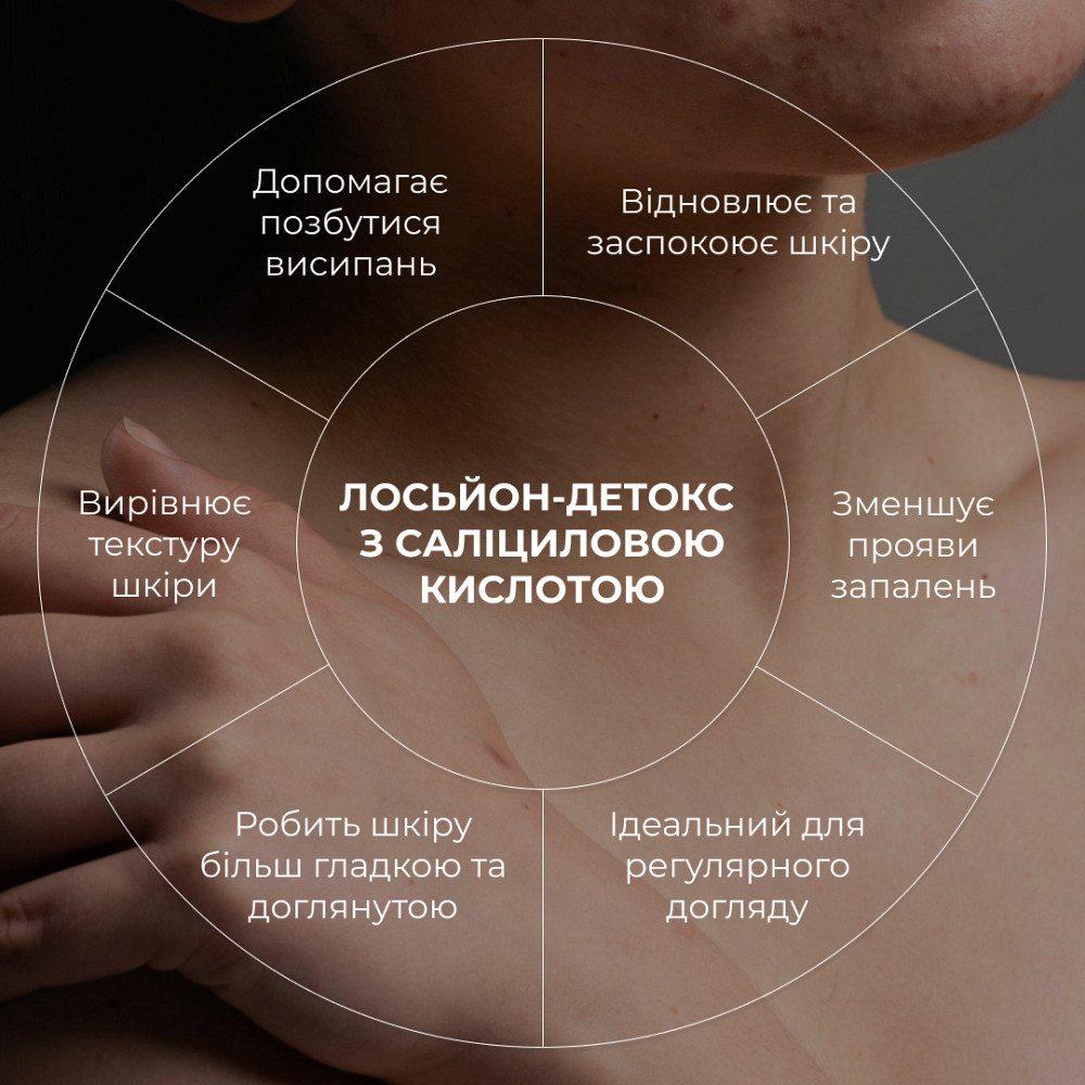 Лосьон-детокс для проблемной кожи с салициловой кислотой Anti-Acne Salicylic Body Lotion Hillary 150 мл Киев - изображение 17