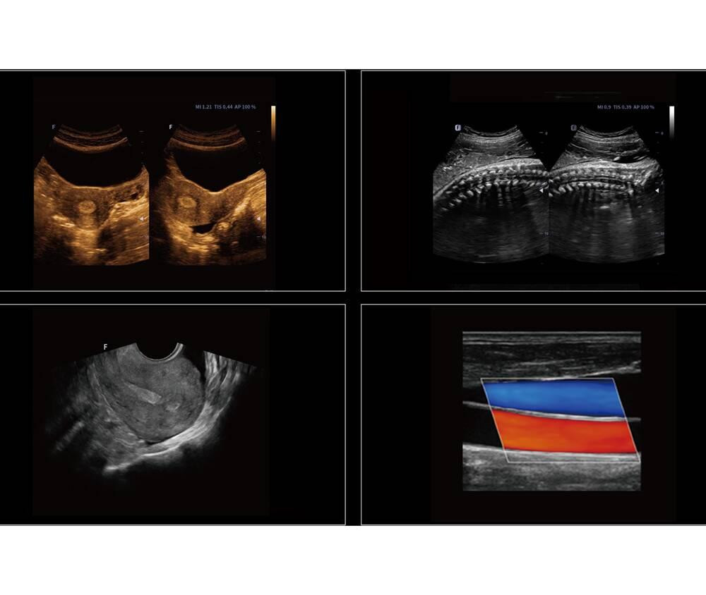 Ультразвукова діагностична система стаціонарна експертного класу +2 датчики Cetus 40 Focus & Fusion Дніпро - фото 2
