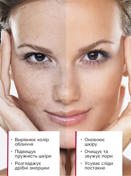 Кислотный пилинг для лица AHA 30%+BHA 1% Reclaire cosmetics 30 мл Киев - изображение 3