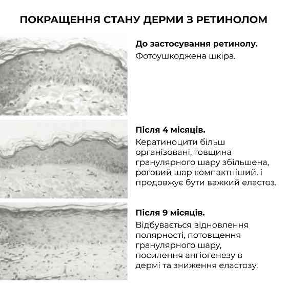 Комплекс глибокого нічного відновлення шкіри ReNuAge Retinol & Collagen Night Ritual Hillary Вінниця