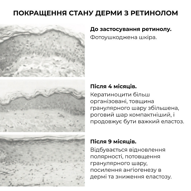 Комплекс глибокого нічного відновлення шкіри ReNuAge Retinol & Collagen Night Ritual Hillary Вінниця - фото 6