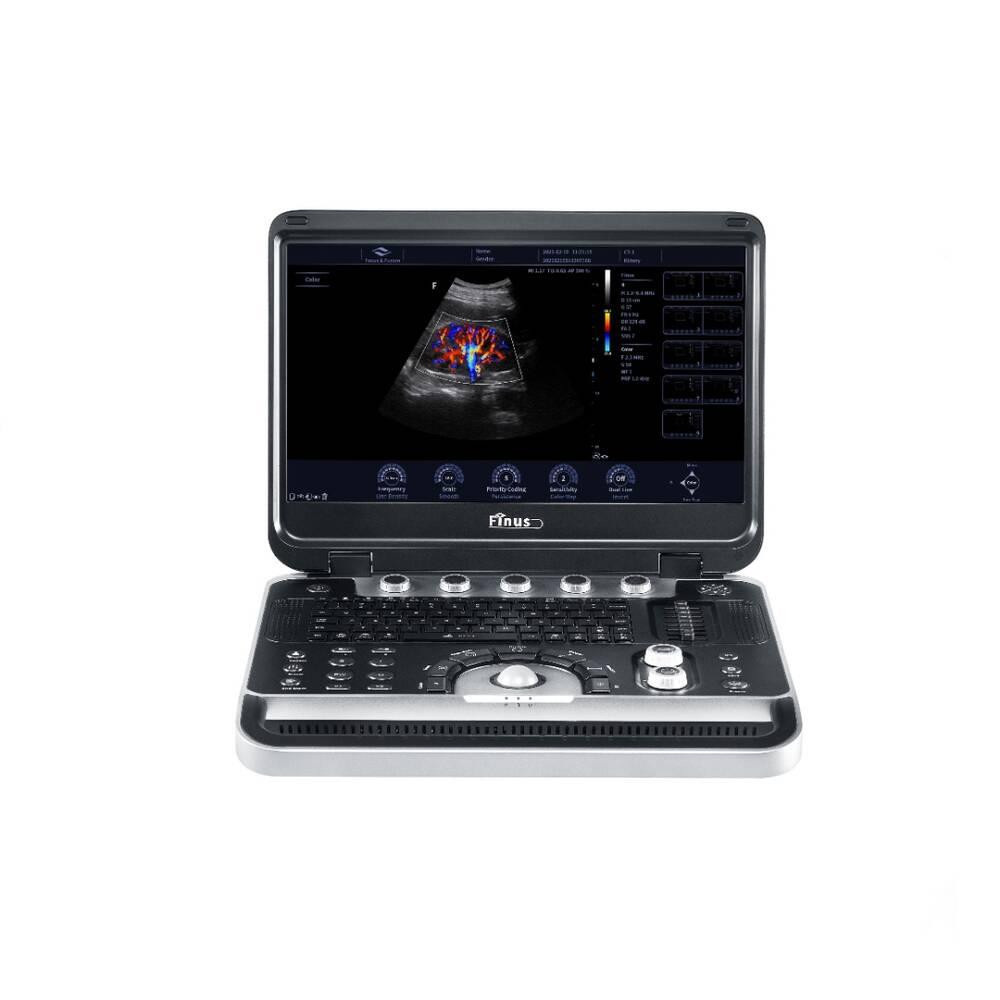 Ультразвукова діагностична система портативна Finus 45 Focus&Fusion Дніпро - фото 5