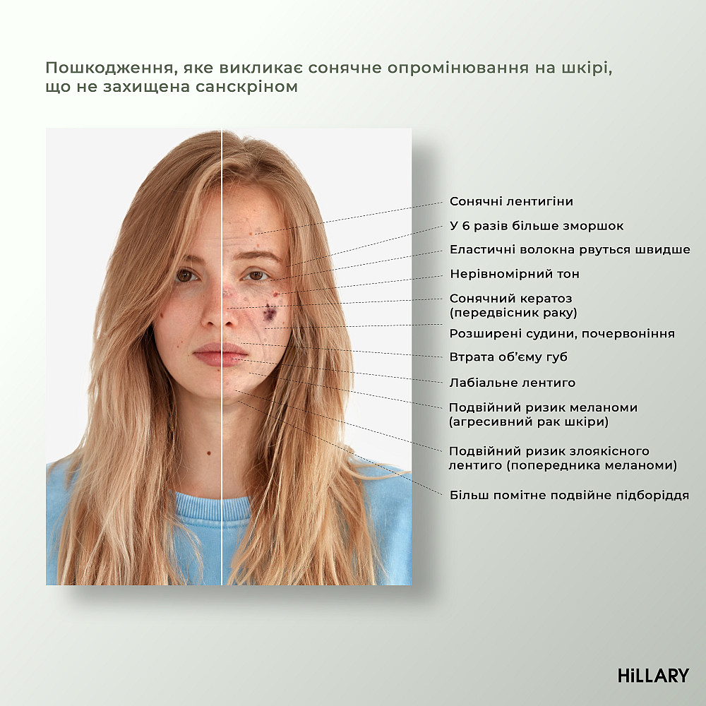 Сонцезахисна сироватка SPF 30 з вітаміном С + Базовий набір для догляду за шкірою обличчя нормального типу Hillary Київ - фото 3