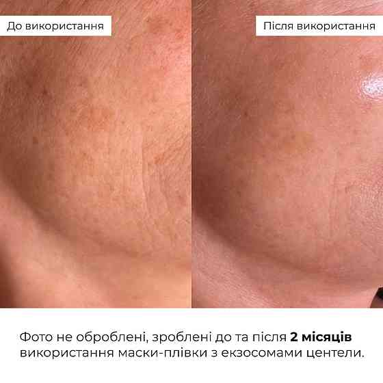 Сияющая маска-пленка с экзосомами центеллы Hillary Centella Exosome Radiance Peel-Off Mask (Blue Edition), 90 мл Киев
