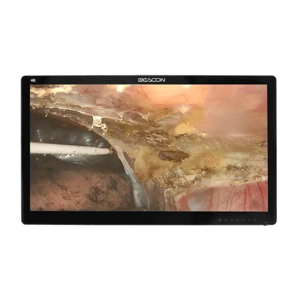 Медичний монітор для ендоскопії та хірургії S3281P 4K 31.5’’ Дніпро - фото 9
