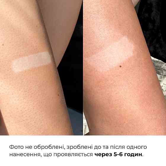 Мусс-автозагар для тела Hillary Self Tan Bronzing Touch, 150 мл Киев