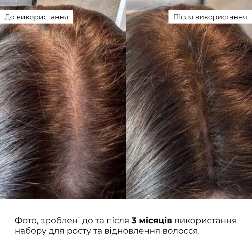 Набор для роста и восстановления волос с протеиновой гранолой Hillary Hair Growth & Recovery Set with Gregory Mill Protein Granola Киев - изображение 7