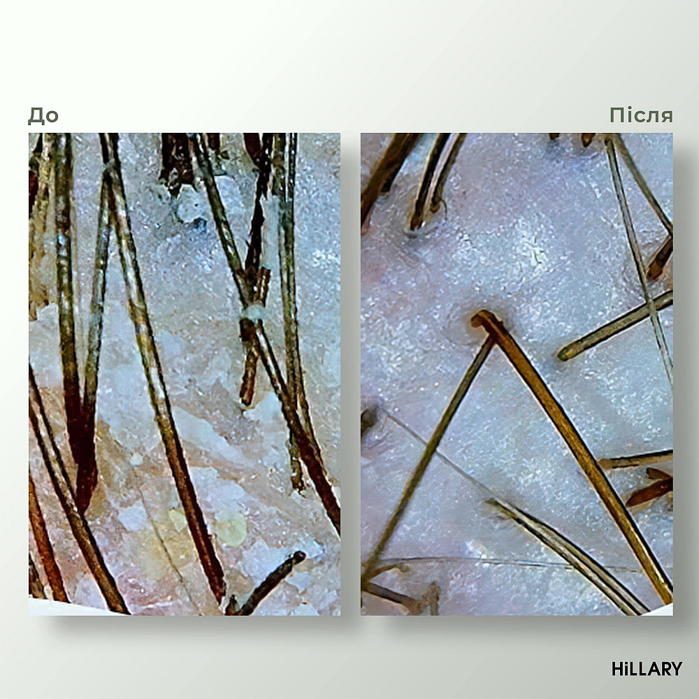 Ензимний пілінг для шкіри голови + Набір для жирного типу волосся Green Tea Phyto-essential Hillary Київ - фото 12