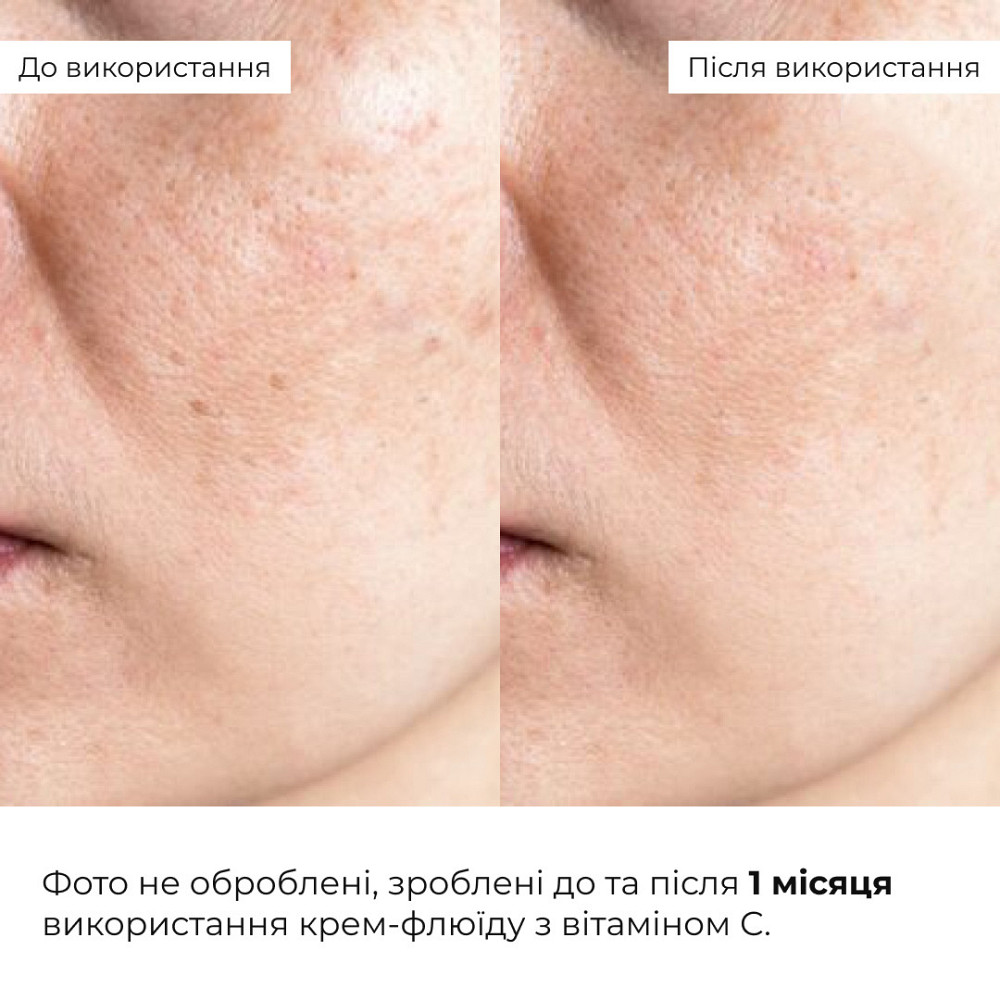 Крем-флюид для интенсивной ревитализации кожи с витамином С Hillary Vitamin C Intensive Skin Revitalization Fluid, 30 мл Киев - изображение 2