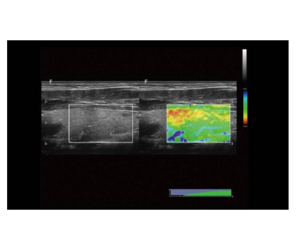 Ультразвукова діагностична система портативна високого класу +2 датчики Finus 50 Focus & Fusion Дніпро - фото 5