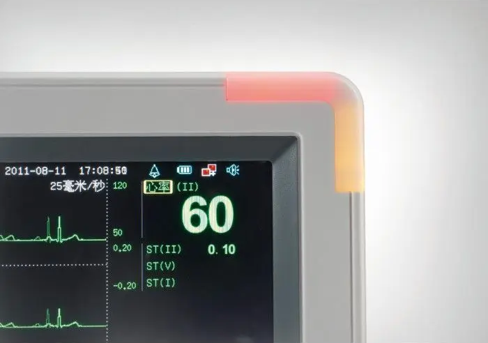 Монітор пацієнта G3L Дніпро - фото 3