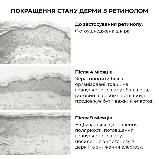 Набір антивікових сироваток з екзосомами та ретинолом ReNuAge Day & Night Anti-Aging Serums Hillary Вінниця - фото 18