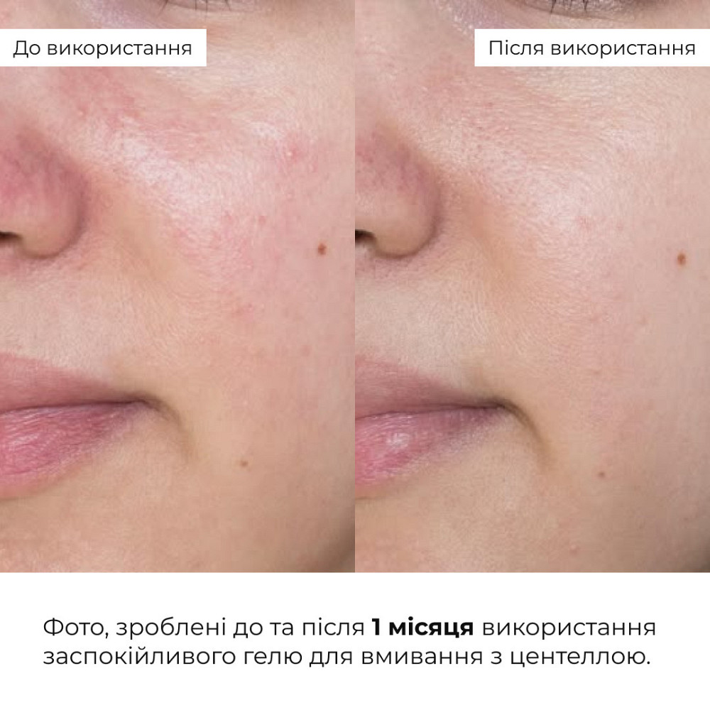 Набор успокаивающий с центеллой Hillary Centella Soothing Set Киев - изображение 3