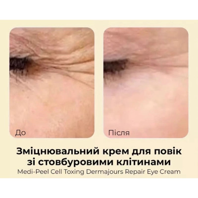 Крем для кожи вокруг глаз Medi-Peel Cell Toxing Dermajours Repair Eye Cream 30 мл (8809409343709) Винница - изображение 7