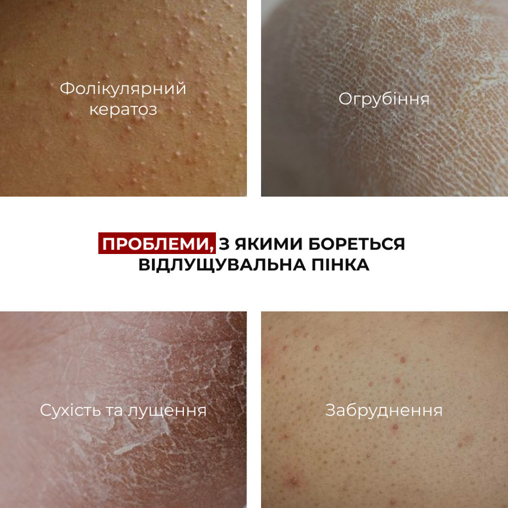 Комплекс для ровного тона кожи и безопасного загара тела Hillary Even Skin Tone & Safe Tan Body Complex Киев - изображение 7