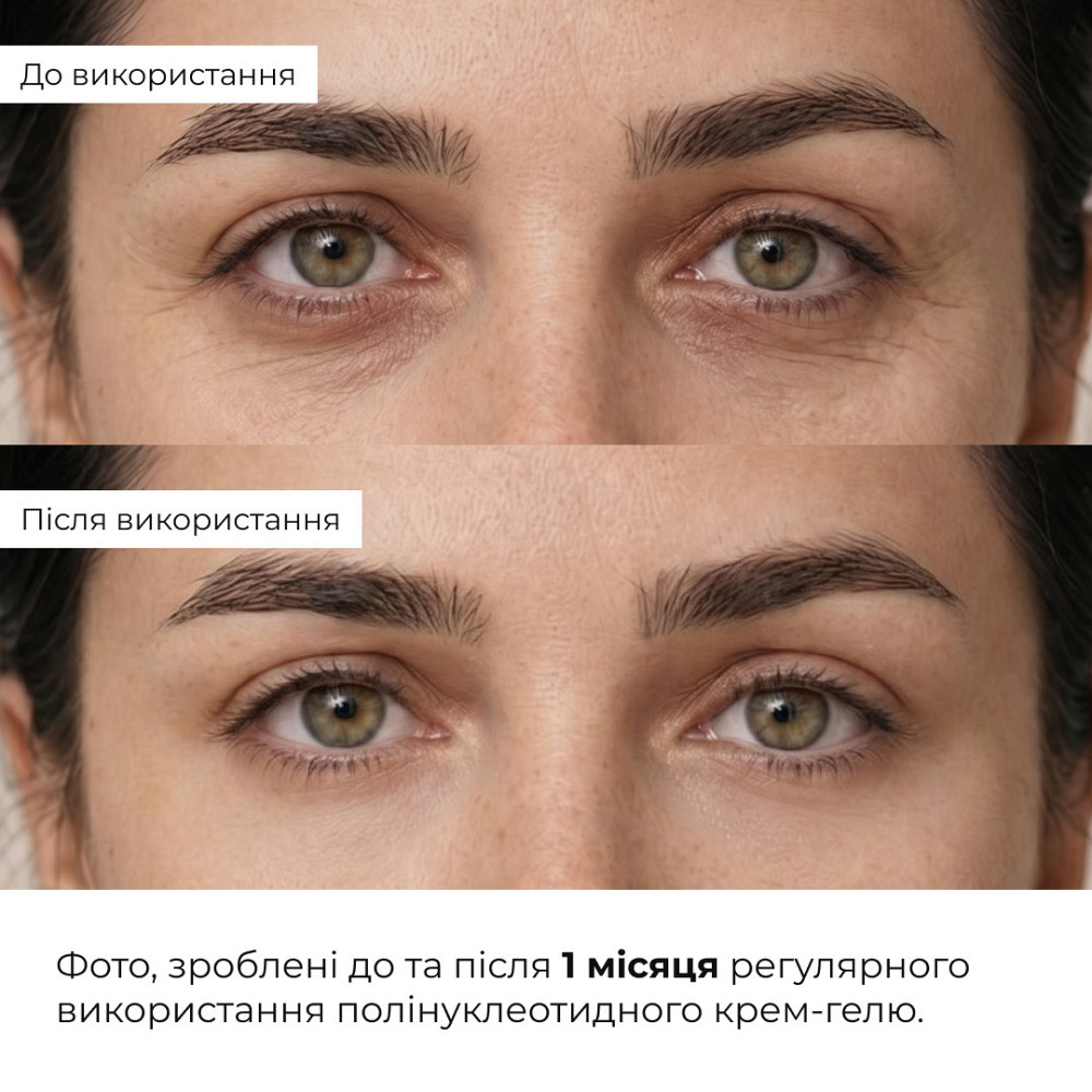 Набор для успокоения кожи и уменьшения признаков усталости вокруг глаз Hillary Soothing Skin & Tired Eye Care Set Киев - изображение 7