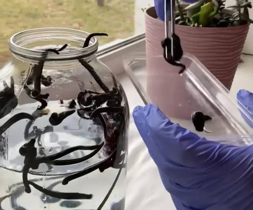 Гирудотерапия – лечение в санатории "Хмельник" Хмельник - изображение 1