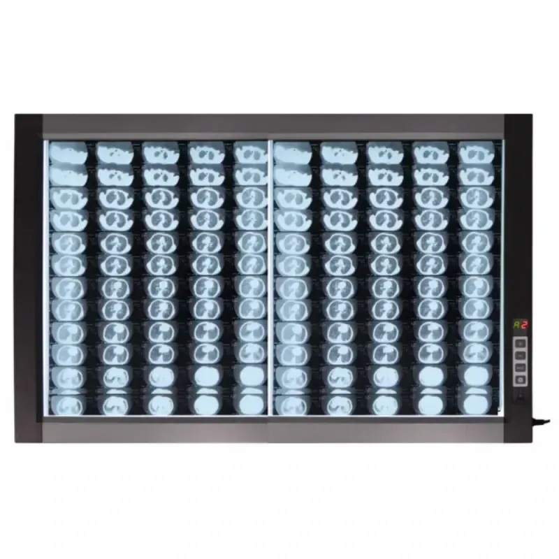 Світлодіодний медичний негатоскоп WL-2D Дніпро - фото 1