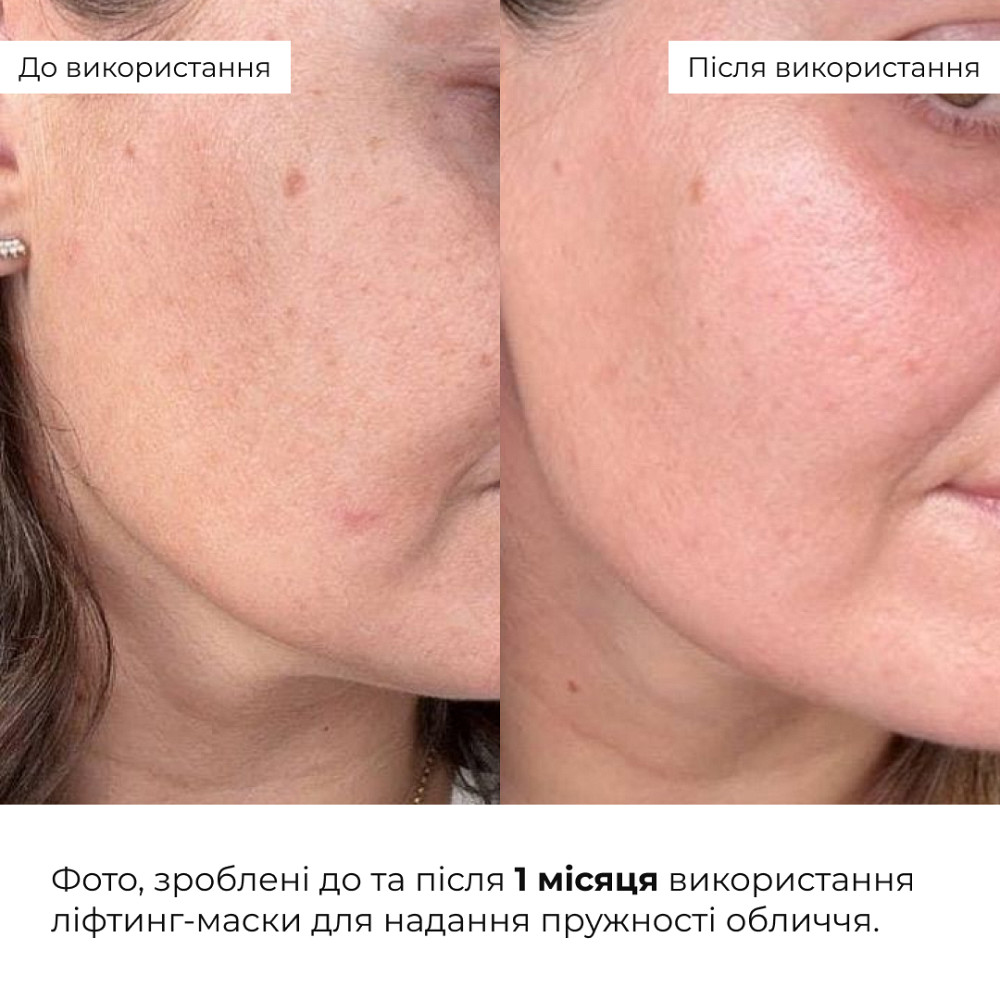 Лифтинг-маска для лица и шеи Collagen & Peptide Lifting Clay Mask Hillary 90 мл Киев - изображение 19