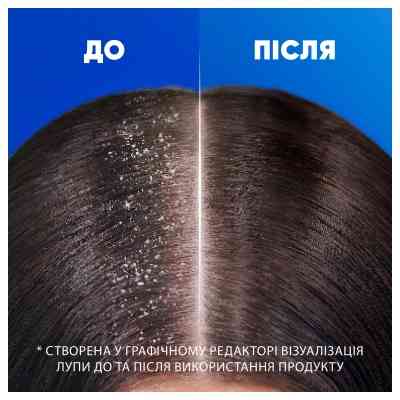Шампунь Head & Shoulders Глубокое увлажнение 250 мл (8700216605281) Винница