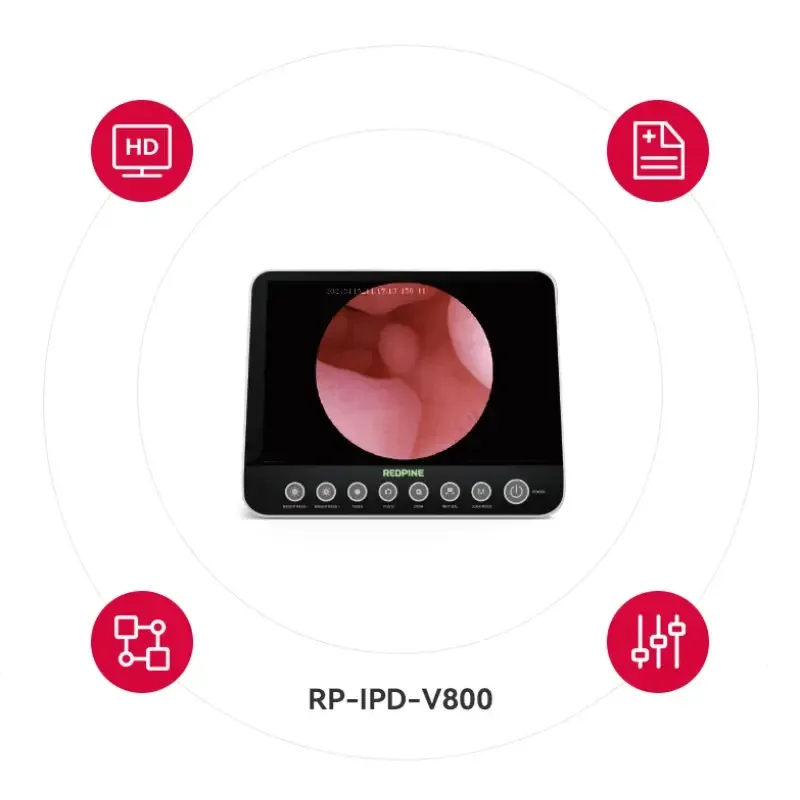 Одноразовий відео гістероскоп RP-G-C0101 Дніпро - фото 2