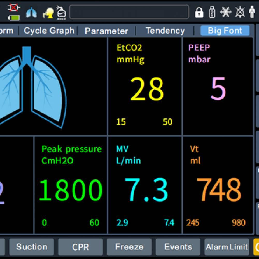 Апарат ШВЛ Т6 Advanced Model Amoul Дніпро - фото 3