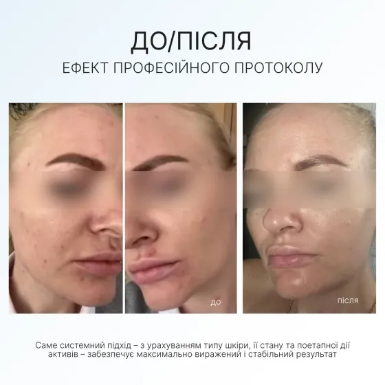 Набір антивіковий Anti-age Set AG Skin Дніпро