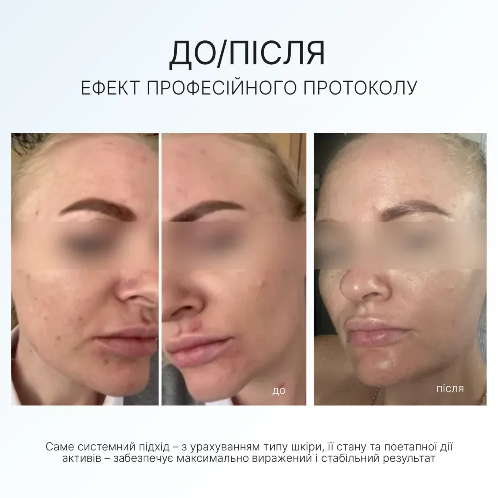 Набір антивіковий Anti-age Set AG Skin Дніпро - фото 3