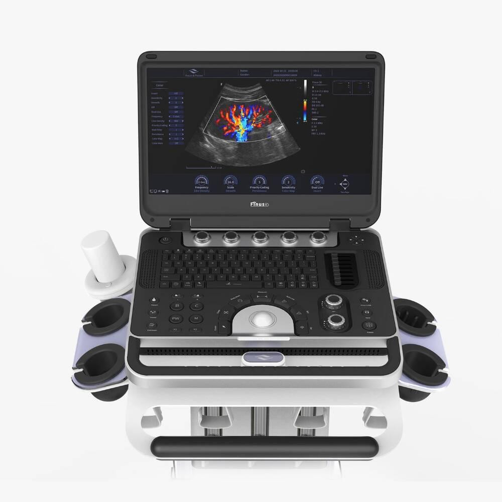 Ультразвукова діагностична система портативна високого класу +2 датчики Finus 50 Focus & Fusion Дніпро - фото 4