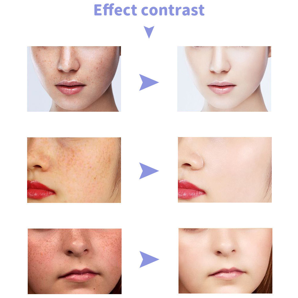 Портативний плазмовий коагулятор Beauco WD-0232 (3 насадки) Вінниця - фото 9