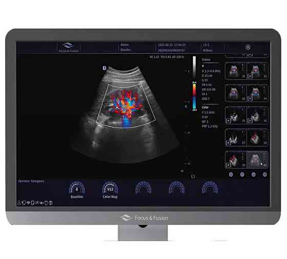 Ультразвукова діагностична система стаціонарна середнього класу Danus 8 Focus & Fusion Дніпро