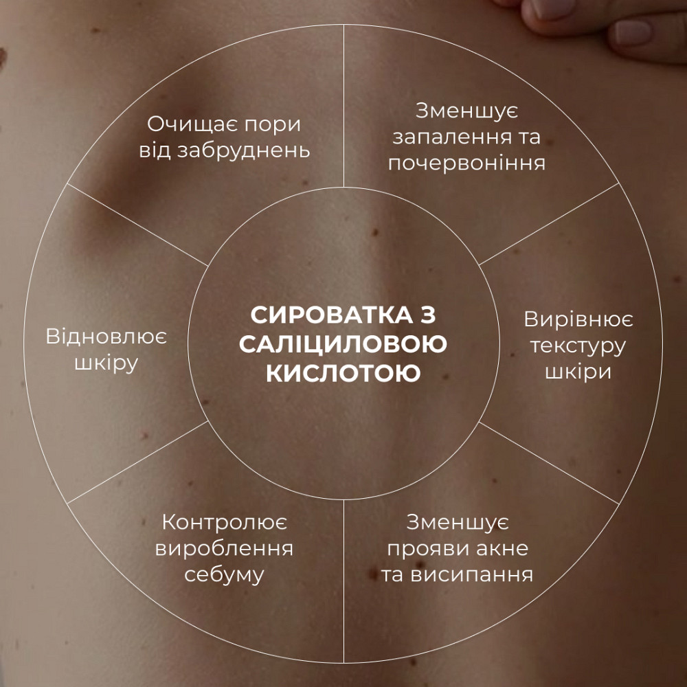 Набір проти запалень і висипань на тілі Back & Body Acne Care Set Hillary Київ - фото 8