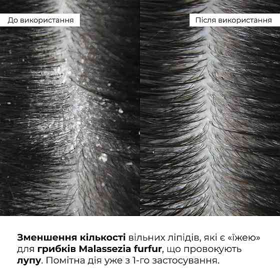 Комплекс для глибокого очищення та відновлення волосся і шкіри голови з термозахистом Hillary Deep Cleanse & Hair Restoration Set Київ