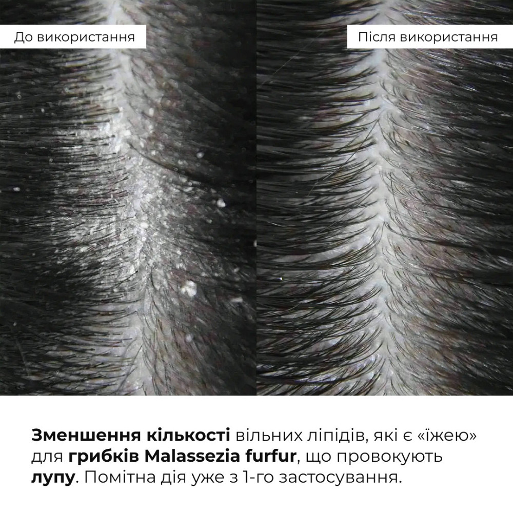 Комплекс для глибокого очищення та відновлення волосся і шкіри голови з термозахистом Hillary Deep Cleanse & Hair Restoration Set Київ - фото 5