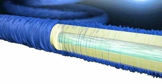 Шланг для поливання розтяжний + пістолет 7 положень Magic Hose 75 метрів (синій) Київ