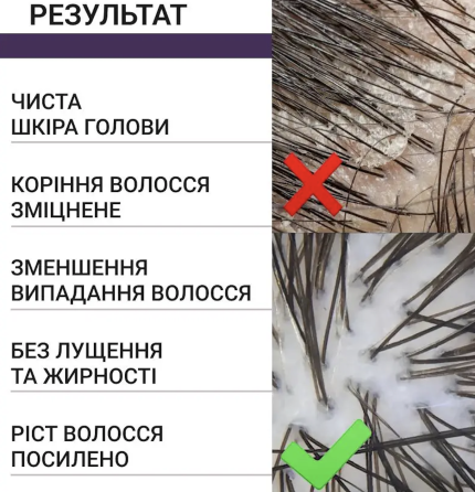 Очищающий набор для кожи головы: Скраб+щетка-массажер Reclaire cosmetics Киев