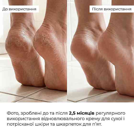 Відновлювальний крем для сухої і потрісканої шкіри ніг HydraHeel Urea & Lanolin Repair Cream Hillary 100 мл Київ