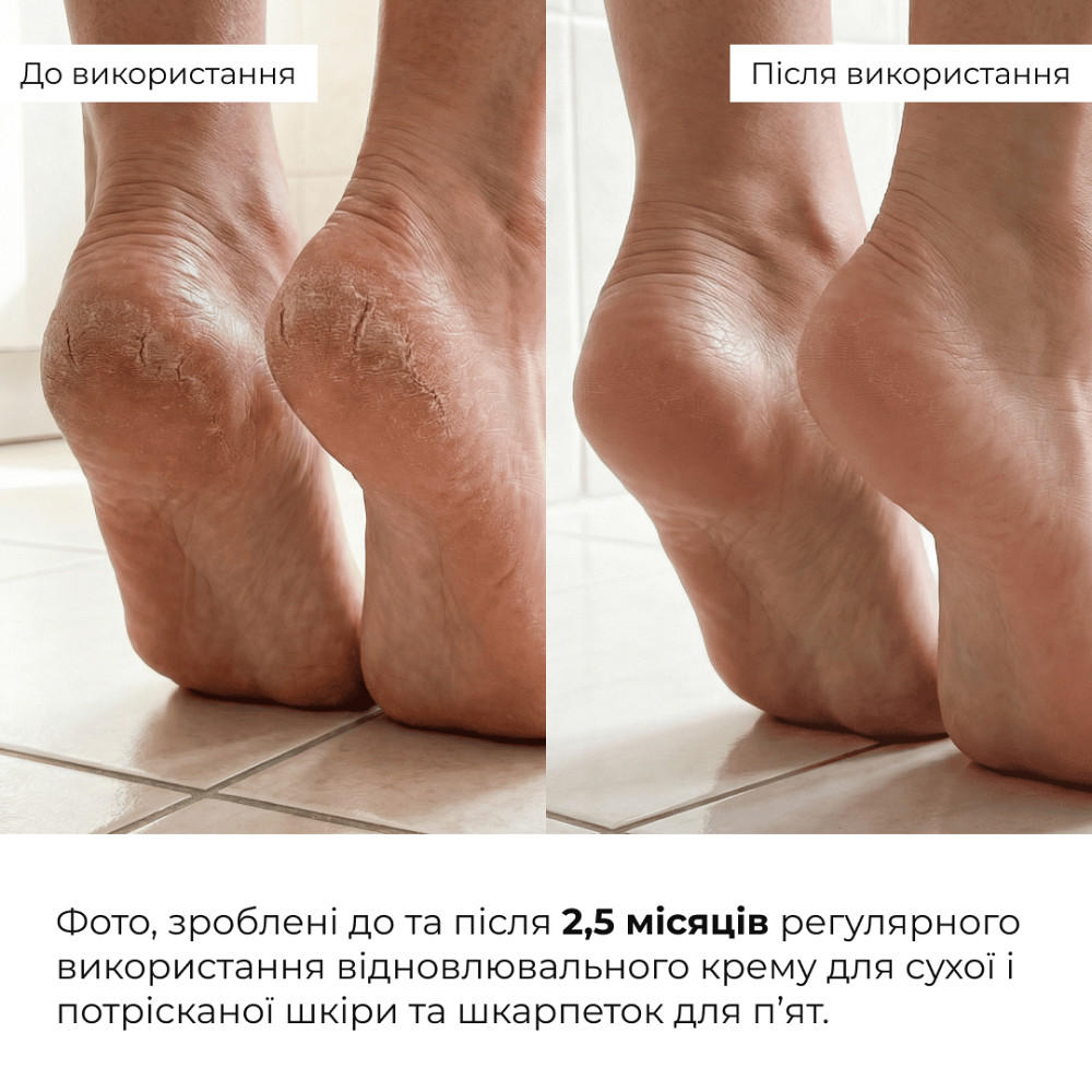 Восстанавливающий крем для сухой и потрескавшейся кожи ног HydraHeel Urea & Lanolin Repair Cream Hillary 100 мл Киев - изображение 4