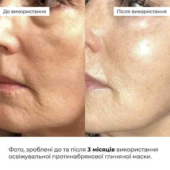 Комплекс для борьбы с отеками и тусклости кожи Hillary Anti-Puffiness & Dullness Skin Care Complex Киев