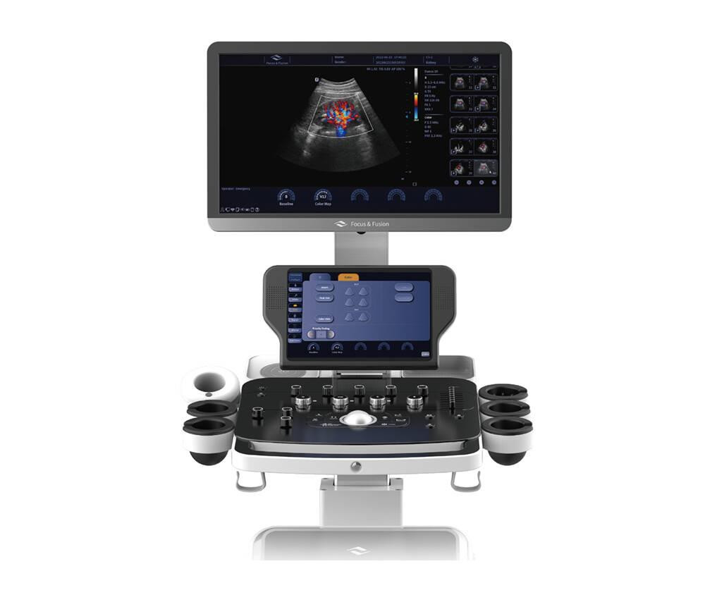 Ультразвукова діагностична система стаціонарна високого класу +2 датчики Danus 10 Focus & Fusion Дніпро - фото 5
