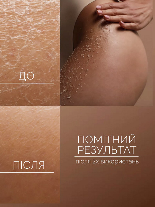 Омолаживающий Талассо-скраб для тела с морской солью и минералами Мертвого моря Reclaire cosmetics 200 мл Киев - изображение 5