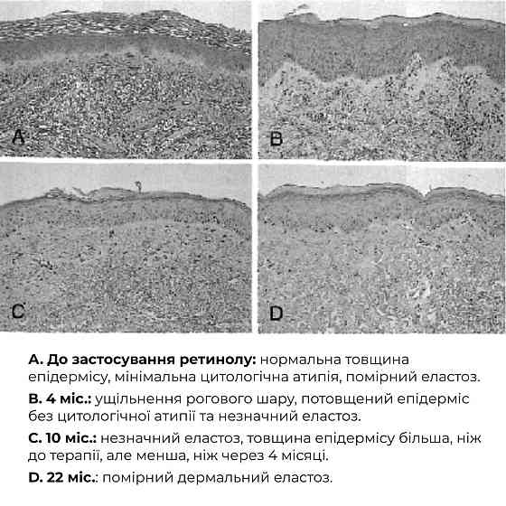 Комплекс глибокого нічного відновлення шкіри ReNuAge Retinol & Collagen Night Ritual Київ
