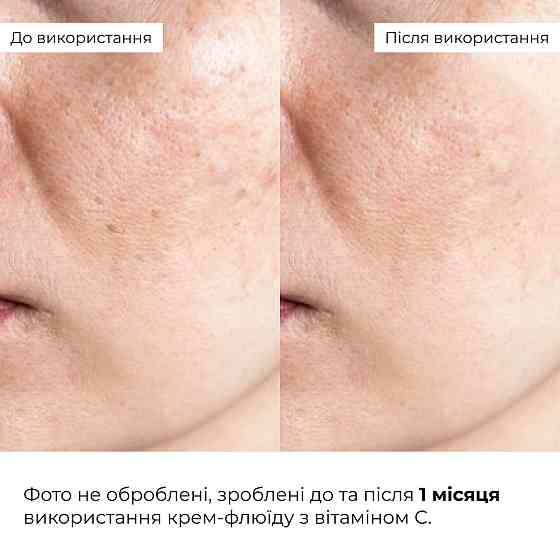 Комплекс для відновлення тону та захист від пігментації SPF 30 Hillary Tone Repair & Pigment Defense Set Киев