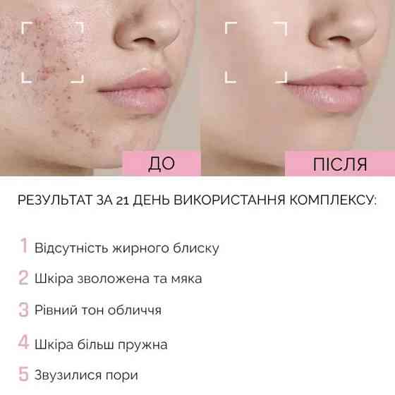 Зволожуючий тонік для обличчя з ніацинамідом Reclaire cosmetics 100 мл Київ